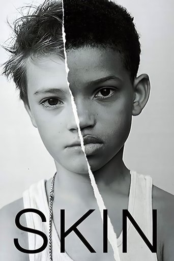 Skin – plakát filmu